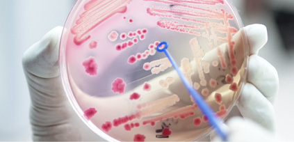 Gloved hand holding a Petri dish with bacteria growing in it. There is a blue inoculation loop being used to make a streak across the Petri dish. 